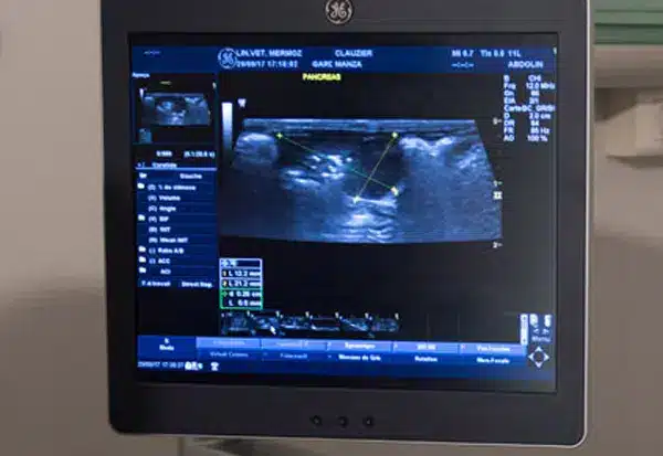 Echographie