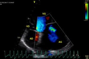 Cardiologie vétérinaire lyon. Une fibrillation atriale