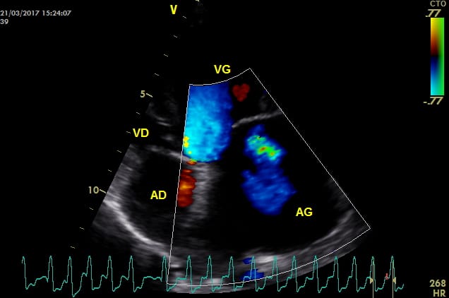 Cardiologie vétérinaire lyon. Une fibrillation atriale